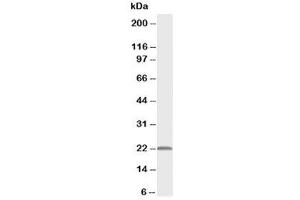 Western blot testing of PMVK antibody and rat heart tissue lysate (PMVK Antikörper  (Middle Region))