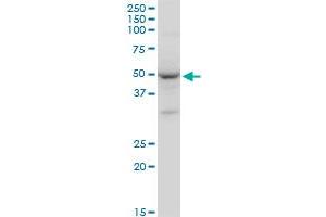 GATA1 monoclonal antibody (M06), clone 3G6. (GATA1 Antikörper  (AA 123-199))