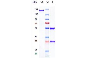 Anti-PDCD1 / PD-1 / CD279 Reference Antibody (spartalizumab) on SDS-PAGE under reducing (R) condition. (Rekombinanter PDCD1 (Spartalizumab Biosimilar) Antikörper)