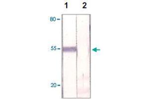 The HeLa cell lysate was immuno-blotted by FOXP1 polyclonal antibody  at 1 : 500 (Lane 1). (FOXP1 Antikörper  (C-Term))