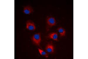 Immunofluorescent analysis of BIM (pS69) staining in HeLa cells. (BIM Antikörper  (pSer69))