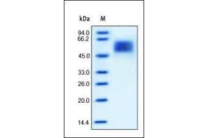 SDS-PAGE (SDS) image for Interleukin 13 Receptor, alpha 1 (IL13RA1) (AA 22-343) (Active) protein (His tag) (ABIN2181335) (IL13 Receptor alpha 1 Protein (AA 22-343) (His tag))