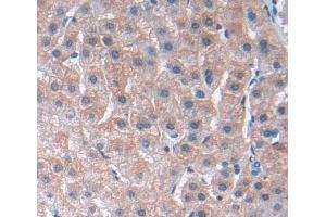 IHC-P analysis of liver tissue, with DAB staining. (PLA2G3 Antikörper  (AA 20-268))