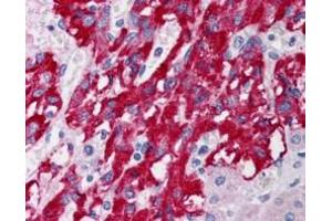 Immunohistochemistry (IHC) image for anti-Deleted in Liver Cancer 1 (DLC1) (N-Term) antibody (ABIN185264)