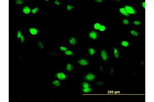 Immunofluorescence of monoclonal antibody to SUPT5H on HeLa cell. (SUPT5H Antikörper  (AA 981-1087))