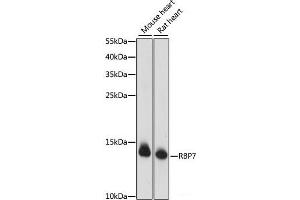 Western blot analysis of extracts of various cell lines using RBP7 Polyclonal Antibody at dilution of 1:1000. (RBP7 Antikörper)