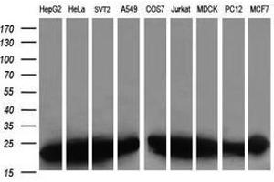 Image no. 6 for anti-Prefoldin Subunit 3 (PFDN3) antibody (ABIN1501701) (VBP1 Antikörper)