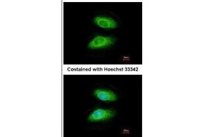 ICC/IF Image Immunofluorescence analysis of methanol-fixed HeLa, using IRAK2, antibody at 1:200 dilution. (IRAK2 Antikörper)
