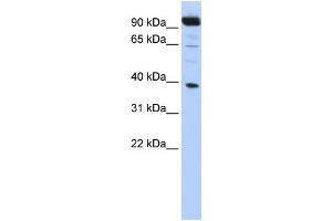 Western Blotting (WB) image for anti-Homeobox B2 (HOXB2) antibody (ABIN2458159)