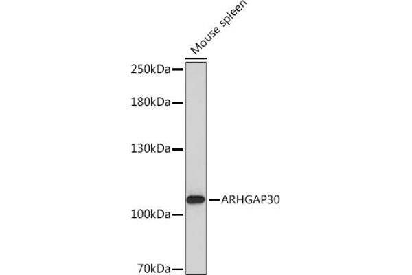 ARHGAP30 抗体  (AA 485-585)