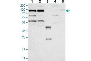 Western blot analysis of Lane 1: RT-4, Lane 2: U-251 MG, Lane 3: Human Plasma, Lane 4: Liver, Lane 5: Tonsil with KIF5C polyclonal antibody  at 1:250-1:500 dilution.