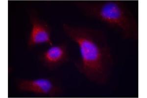 Image no. 2 for anti-Spleen tyrosine Kinase (SYK) (pTyr323) antibody (ABIN319292) (SYK Antikörper  (pTyr323))