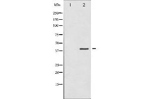 Western blot analysis of hnRNP C1/2 phosphorylation expression in H2O2 treated 293 whole cell lysates,The lane on the left is treated with the antigen-specific peptide. (HNRNPC Antikörper  (pSer260))