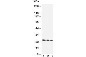 Western blot testing of HOXA6 antibody and Lane 1. (HOXA6 Antikörper  (Middle Region))