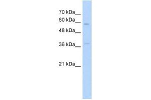 ITGBL1 antibody used at 5 ug/ml to detect target protein.