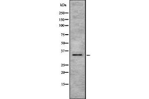 Western blot analysis of HSD17B1 using MCF7 whole  lysates. (HSD17B1 Antikörper  (C-Term))