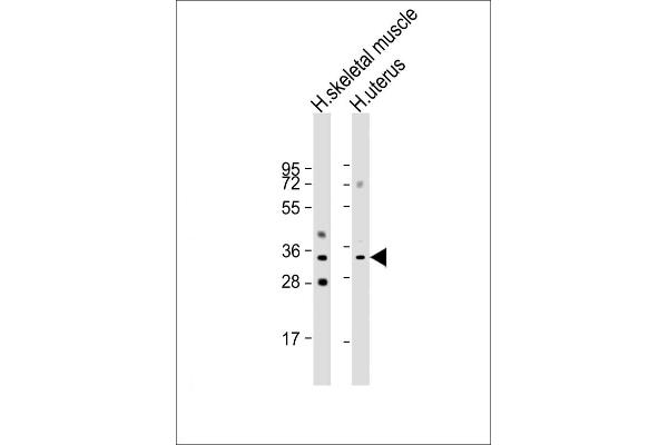 R-Spondin 3 Antikörper  (AA 197-230)