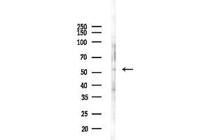 Western blot analysis of lysates from COLO205 cells(heat-shock,45 min treatment), using Activin Receptor Type IA Antibody at 1/1000 dilution.