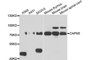 Western blot analysis of extracts of various cell lines, using CAPN5 antibody (ABIN5975527) at 1/1000 dilution. (Calpain 5 Antikörper)