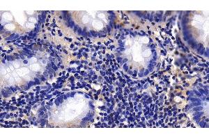 Detection of CNN1 in Human Appendix Tissue using Polyclonal Antibody to Calponin 1, Basic (CNN1) (CNN1 Antikörper  (AA 1-268))