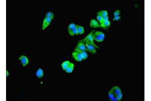 Immunofluorescent analysis of MCF-7 cells using ABIN7164978 at dilution of 1:100 and Alexa Fluor 488-congugated AffiniPure Goat Anti-Rabbit IgG(H+L) (PSMB4 Antikörper  (AA 46-264))