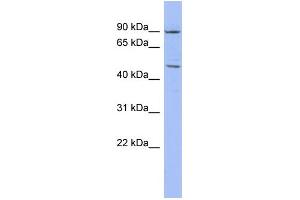 WB Suggested Anti-ZNF569 Antibody Titration:  0. (ZNF569 Antikörper  (N-Term))