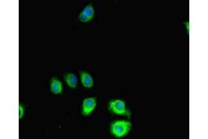 Immunofluorescent analysis of A549 cells using ABIN7169823 at dilution of 1:100 and Alexa Fluor 488-congugated AffiniPure Goat Anti-Rabbit IgG(H+L) (SLIT-ROBO rho GTPase Activating Protein 2C (SRGAP2C) (AA 1-242) Antikörper)