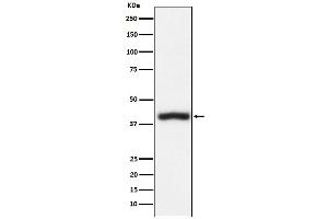 Western blot analysis of CD1c expression in Jurkat cell lysate.