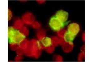 Immunofluorescence (IF) image for anti-Epstein-Barr Virus Membrane Antigen gp350 (EBV gp350) antibody (ABIN265550) (EBV-Gp350 Antikörper)