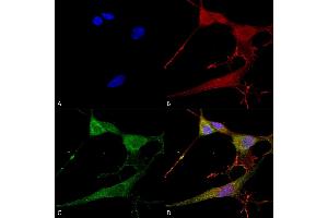 Immunocytochemistry/Immunofluorescence analysis using Mouse Anti-NrCAM Monoclonal Antibody, Clone S364-51 (ABIN1741303). (NrCAM Antikörper  (Extracellular Domain) (PE))