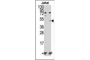 Western blot analysis of anti-MINA (C-term) Pab pre-incubated with and without blocking peptide (BP)(catlog :BP1033b) in Jurkat cell line lysate.