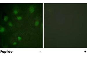 Immunofluorescence analysis of HeLa cells, using IGF2R polyclonal antibody .
