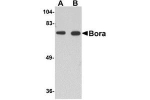 Western blot analysis of Bora in mouse brain tissue lysate with AP30161PU-N Bora antibody at (A) 1 and (B) 2 μg/ml. (BORA Antikörper  (C-Term))
