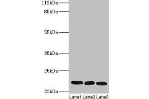 SSSCA1 Antikörper  (AA 2-199)