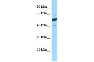WB Suggested Anti-SUCLG2 Antibody Titration: 1. (SUCLG2 Antikörper  (C-Term))