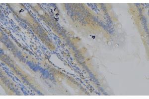 ABIN6279109 at 1/100 staining Mouse colon tissue by IHC-P.