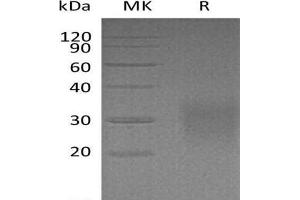Western Blotting (WB) image for CD83 (CD83) (AA 22-134) protein (His tag) (ABIN7320709) (CD83 Protein (CD83) (AA 22-134) (His tag))