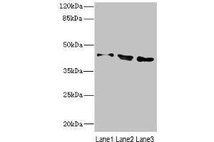 Western blot All lanes: CAMK1Dantibody at 2. (CAMK1D Antikörper  (AA 1-180))