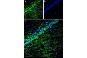Expression of TARP γ8 (CACNG8) in rat hippocampus - Immunohistochemical staining of rat hippocampus using Anti-CACNG8 Antibody (ABIN7042996, ABIN7044073 and ABIN7044074). (CACNG8 Antikörper  (Intracellular, N-Term))