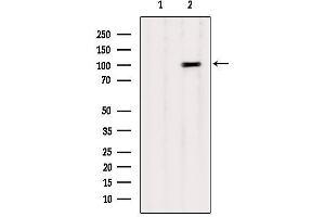 Western blot analysis of extracts from B16F10, using CTNNA1 Antibody.