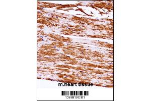 Mouse Map3k5 Antibody immunohistochemistry analysis in formalin fixed and paraffin embedded mouse heart tissue followed by peroxidase conjugation of the secondary antibody and DAB staining. (ASK1 Antikörper  (C-Term))