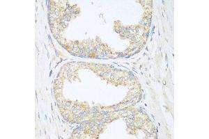 Immunohistochemistry of paraffin-embedded human prostate using SGCB antibody at dilution of 1:100 (40x lens). (SGCB Antikörper)
