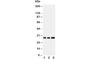 Western blot testing of Oncostatin M antibody and Lane 1:  A549;  2: A549;  3: HeLa cell lysate