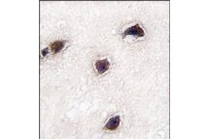 Formalin-fixed and paraffin-embedded human brain tissue reacted with CABP1 antibody (C-term), which was peroxidase-conjugated to the secondary antibody, followed by DAB staining. (CABP1 Antikörper  (C-Term))