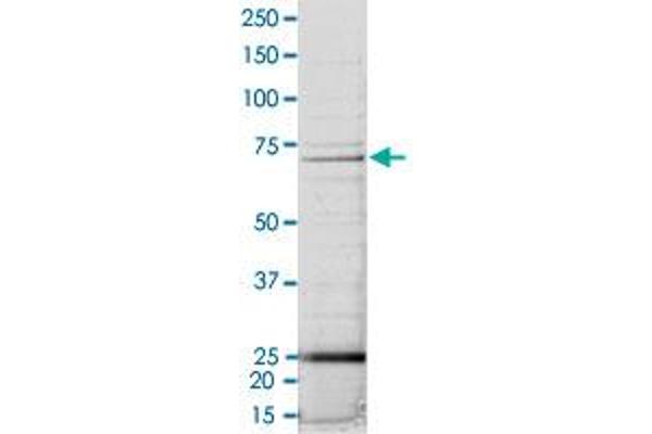 CSNK1A1 Protein (AA 1-365) (His-GST)