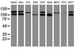 Image no. 2 for anti-SUMO1/sentrin/SMT3 Specific Peptidase 2 (SENP2) (AA 139-523) antibody (ABIN1490928) (SENP2 Antikörper  (AA 139-523))