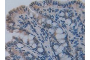 Immunohistochemistry (IHC) image for anti-Caspase 12 (Gene/pseudogene) (CASP12) (AA 1-413) antibody (ABIN7442993)