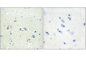 Immunohistochemistry analysis of paraffin-embedded human brain tissue, using GAS6 Antibody. (GAS6 Antikörper  (AA 291-340))