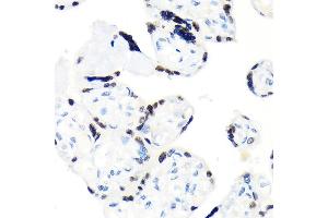 Immunohistochemistry of paraffin-embedded human placenta using RCC1 Rabbit mAb (ABIN1512845, ABIN3021028, ABIN3021029 and ABIN7101332) at dilution of 1:100 (40x lens). (RCC1 Antikörper)