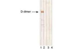 D-dimer, D-monomer and fibrinogen immunodetectionby MAb DD1 in Western blotting. (D-Dimer Antikörper)